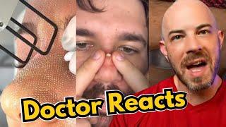 Crazy Skin Treatment Reactions by Dermatologist!