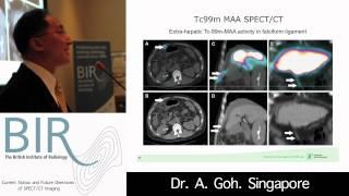 Current Status and Future Directions of SPECT/CT Imaging: SPECT/CT in SIRT