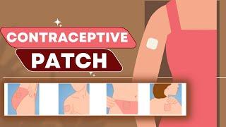 Contraceptive Patch aka Birth Control Patch