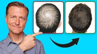 Saçınızı Yeniden Nasıl Çıkarabilirsiniz (GÜNCEL ÖNEMLİ BİLGİLER) | Dr.Berg Türkçe