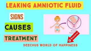 Leaking Amniotic Fluid: Signs, Causes And Treatment  |English