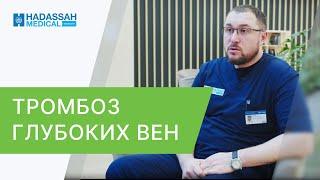  Как вылечить тромбоз глубоких вен, диагностика и методы. Как вылечить тромбоз глубоких вен. 12+