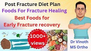 Fracture healing Foods|Post Fracture diet plan |Foods for Early fracture recovery|Bone healing foods