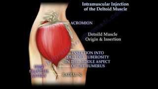 Intramuscular injection of the deltoid muscle  - Everything You Need To Know - Dr. Nabil Ebraheim