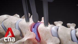 New minimally invasive disc replacement surgical technique for elderly patients with osteoporosis