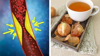 You Won't Believe What Onion Peels Can Do For Your Health!