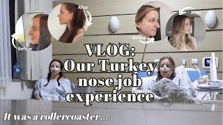 VLOG: We got twin NOSE JOBS in Turkey - Surgery, recovery, & cast removal