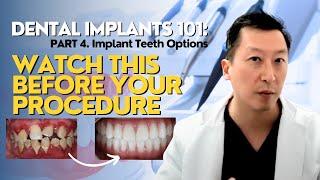 Dental Implants 101: What You NEED to Know! Part 4 (Implant Teeth Options)