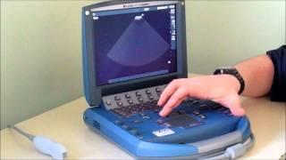 BCF Technology, Sonosite MicroMaxx veterinary ultrasound scanner -- Step by step instructional guide