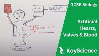 Artificial Hearts, Artificial Blood & Artificial Valves - Biology GCSE | kayscience.com