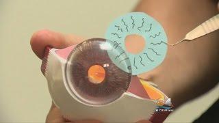 Implants For "Bright Eyes" Have Risks