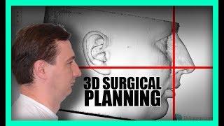 3D Virtual Surgical Planning  (ORTHOGNATHIC)