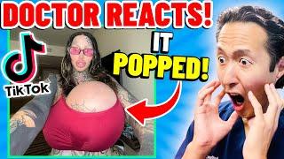 Plastic Surgeon Reacts to SHOCKING TikTok Videos!