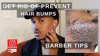 How to Get Rid of Hair Bumps Razor Bumps, Ingrown Hairs or Pseudofolliculitis