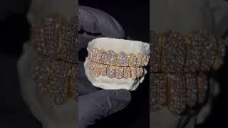 10 on10 silver VVS 6 pointer Lab diamond with yellow gold plating grillz. #hiphop #rap #artist