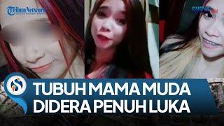 Tubuh Mama Muda Yang Lecehkan 17 Anak Penuh Luka, Keluarga Yakin Nt Korban, Kuak Sikap Suami: Jijik