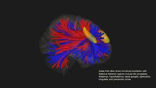 Functional connectivity of the Salience Network (SN)