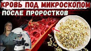 Кровь под микроскопом после проростков (микрозелень)