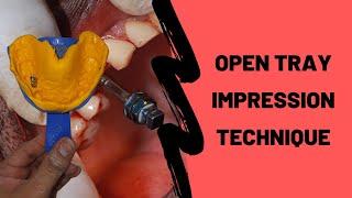 How To Take an Open Tray Implant Impression? DEMO