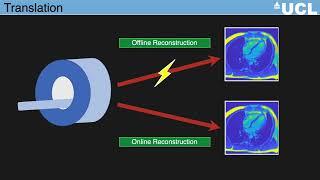 ISMRM MR Academy: Translating Advanced Reconstruction Methods into the Clinical Environment