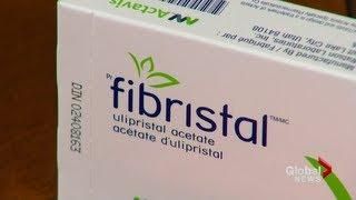 New fibroids drug treatment