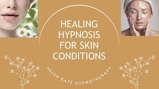 Heal Skin Conditions Naturally: Hypnosis For Eczema, Acne, And Allergies