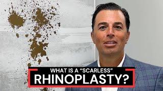 Scarless Rhinoplasty | Dr. Anthony Corrado