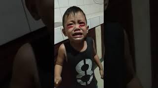 Umiyak ung anak ko  kasi dumugo yung Mata nya