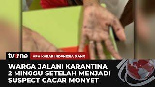 Suspek Cacar Monyet, Warga Palembang Dikarantina Mandiri 2 Minggu | AKIS tvOne