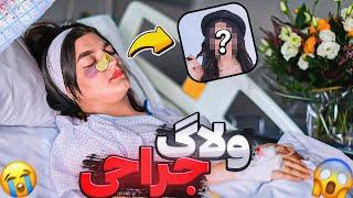 بلاخره دماغ عقابیمو عمل کردم!  چی شدم!