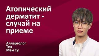 145.11 Атопический дерматит - случай на приеме. Мён Су Тен, врач-аллерголог, иммунолог