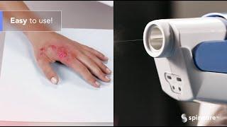 Nanomedic's Spincare In-Office Demonstration