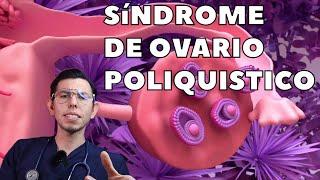 ¿Qué debes conocer del SÍNDROME DE OVARIO POLIQUISTICO? |Drpologuerrero