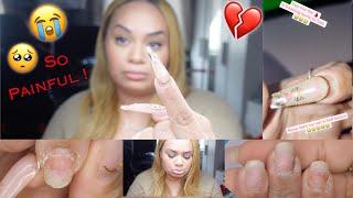 MY BROKEN NAIL  IT HURTS SO BAD | NATURAL NAIL CRACK REPAIR | REMOVING HARD GEL NAILS