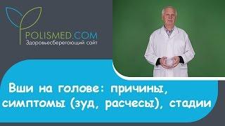 Головной педикулез (вшивость): причины, симптомы (зуд, расчесы), стадии