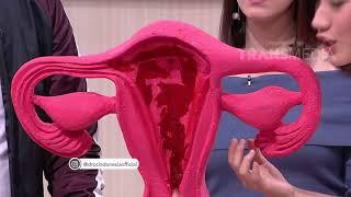 DR OZ - Menstruasi Yang Sakit Sampai Pingsan (13/5/18) Part 3