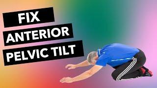 Fix Anterior Pelvic Tilt (4 Critical Exercises)