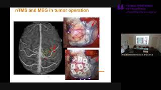 Charla: «Towards exploring the full potential of TMS”