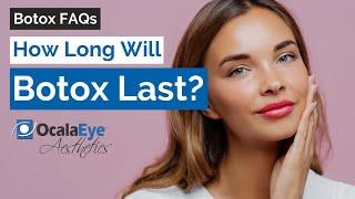 How Long Will Botox Last?