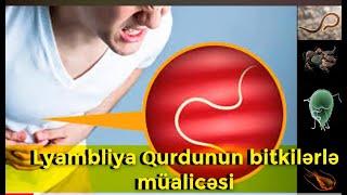 Lyambliya Qurdunun bitkilərlə müalicəsi