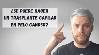 TRASPLANTE DE PELO EN CABELLO CANOSO O CON CANAS