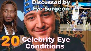 Celebrity Eye Conditions | Discussed by an Eye Surgeon