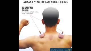 TITIK BEKAM SUNNAH RASULULLAH