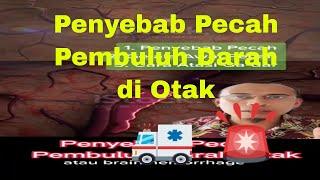 Penyebab Pecahnya Pembuluh Darah di Otak