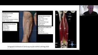 Optimising Ultrasound Imaging of the Hamstring