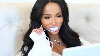 Smart Smile - The Teeth Whitening Kit That Actually Works!