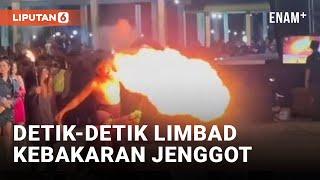 Ngeri! Limbad Alami Luka Bakar di Wajah Saat Lakukan Atraksi Sembur Api | Liputan6