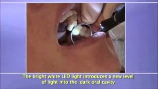 LumiEST — стоматологическое зеркало с подсветкой