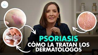  TRATAMIENTO para la PSORIASIS ¿Tiene CURA? | Te lo EXPLICO TODO @drapilarochoa - Dermatologa