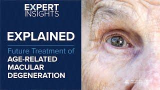 Expert Insights: Future Treatment of Age-Related Macular Degeneration